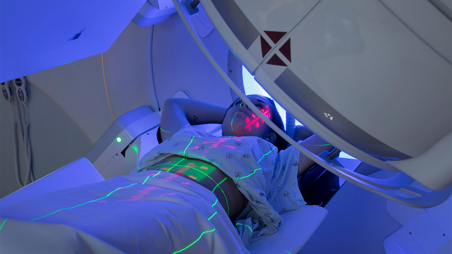 Radiation Therapy